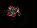 Detected Lichen